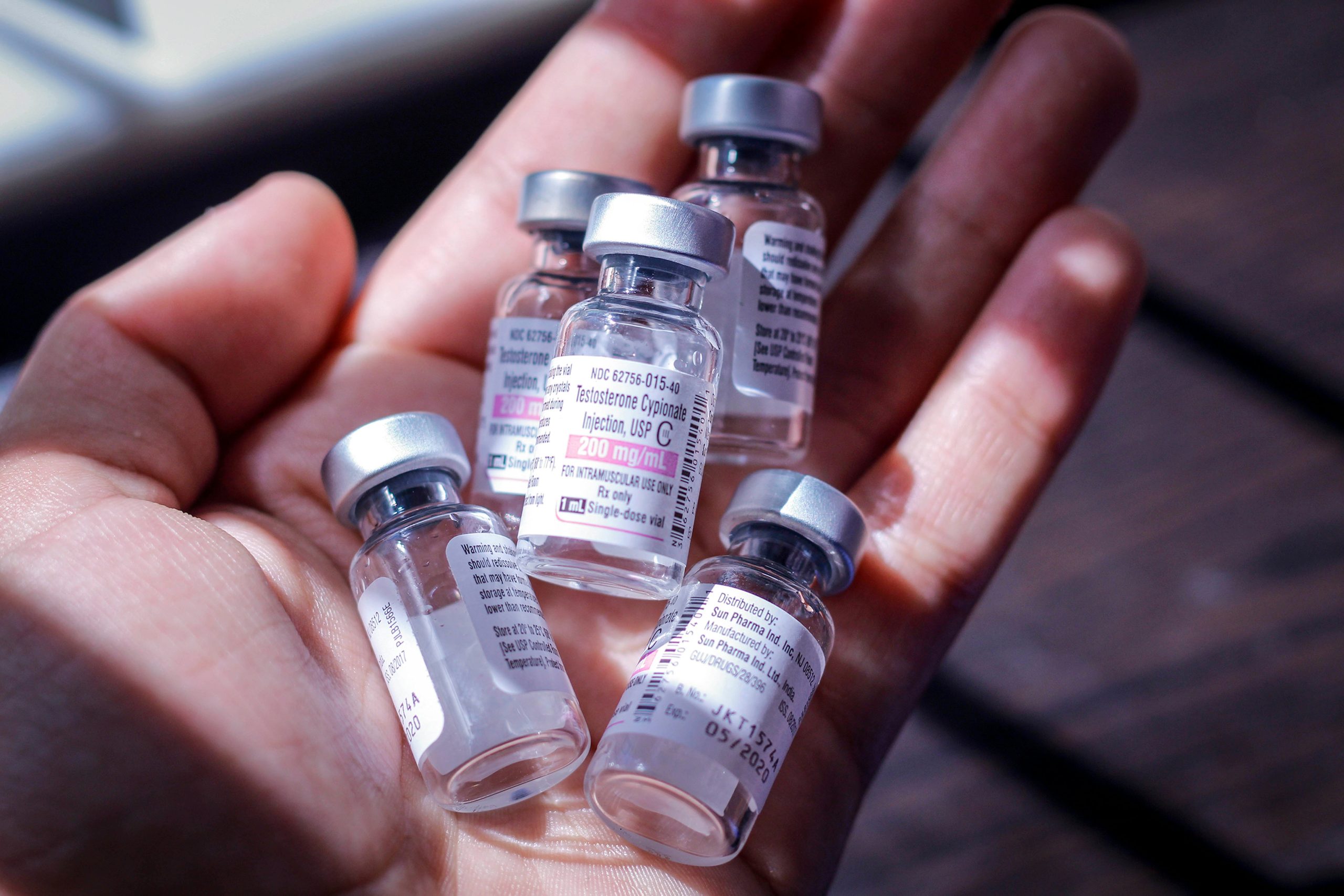 Can diabetic patients experience reduced gastrointestinal motility (gastroparesis) due to long-term high blood sugar?